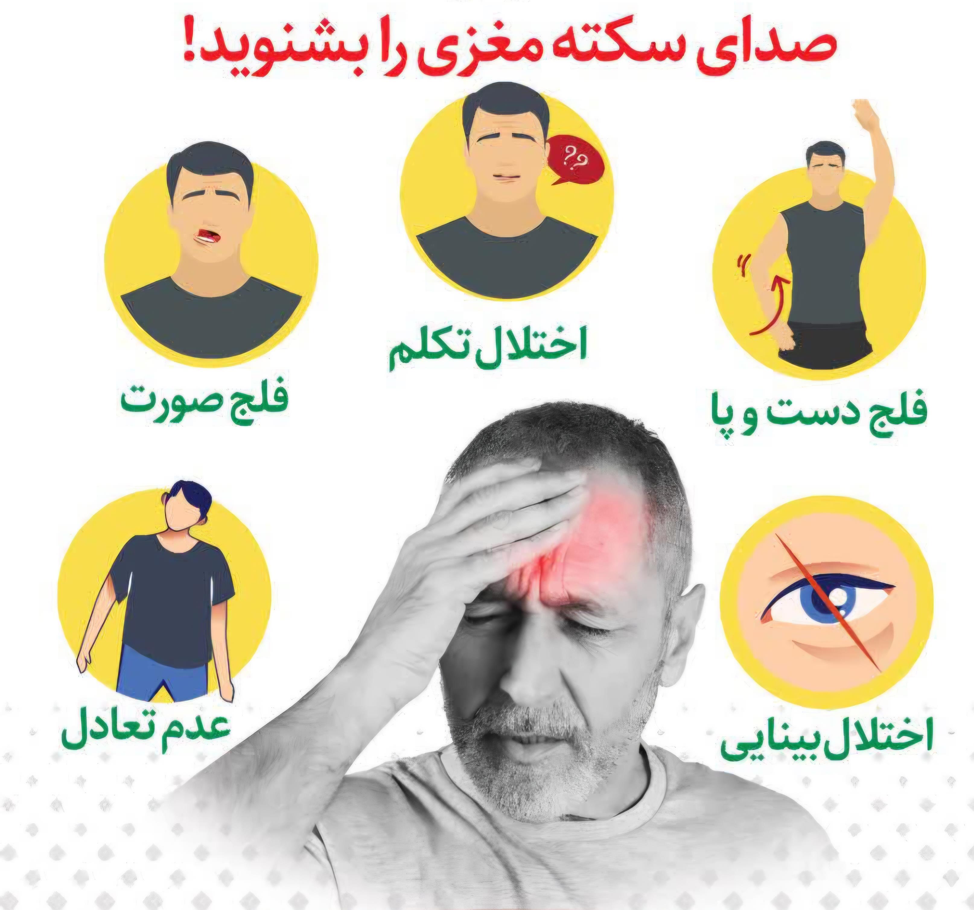 سکته مغزی